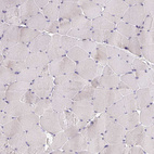 Immunohistochemical staining of human Skeletal muscle shows no positivity in myocytes as expected.