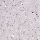Immunohistochemical staining of human Skeletal muscle shows no positivity in myocytes as expected.