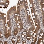 Immunohistochemical staining of human duodenum shows moderate cytoplasmic positivity in glandular cells.