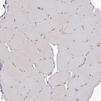 Immunohistochemical staining of human skeletal muscle shows no cytoplasmic positivity in myocytes as expected.
