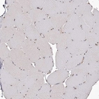 Immunohistochemical staining of human skeletal muscle shows no cytoplasmic positivity in myocytes as expected.