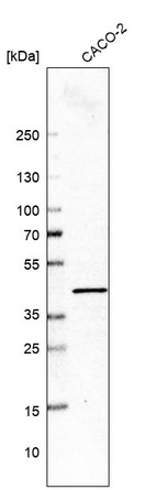 Western blot analysis in human cell line CACO-2.