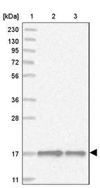Lane 1: Marker [kDa] 230, 130, 95, 72, 56, 36, 28, 17, 11_br/_Lane 2: Human cell line RT-4_br/_Lane 3: Human cell line U-251MG sp