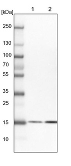 Lane 1: NIH-3T3 cell lysate (Mouse embryonic fibroblast cells)_br/_Lane 2: NBT-II cell lysate (Rat Wistar bladder tumour cells)