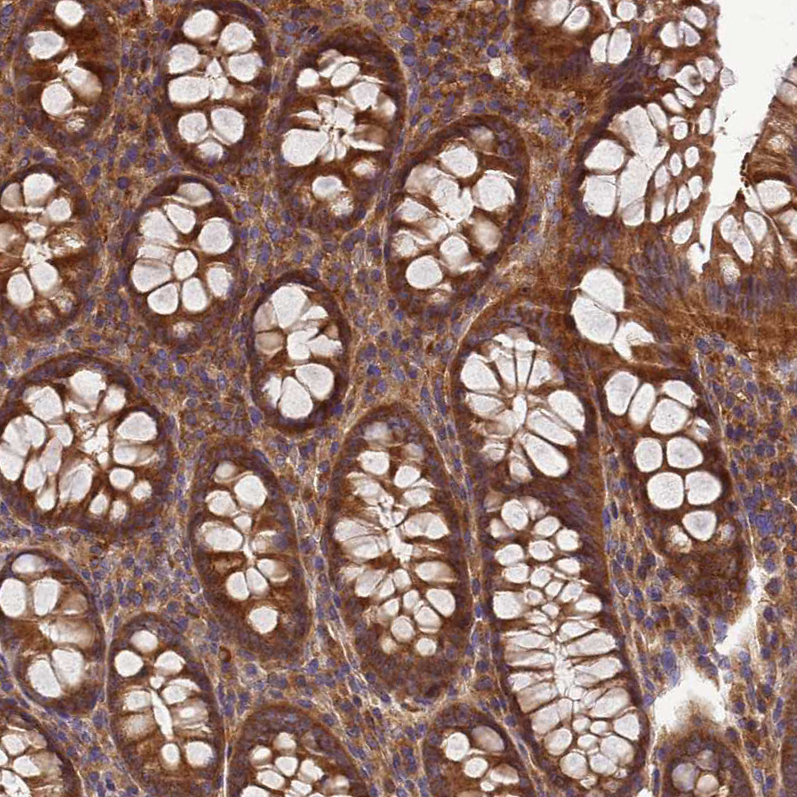 Anti-BECN1 Antibody