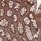 Anti-BECN1 Antibody