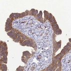Immunohistochemical staining of human fallopian tube shows moderate to strong cytoplasmic positivity in glandular cells.