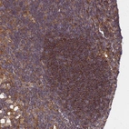 Immunohistochemical staining of human lymph node shows moderate to strong cytoplasmic positivity in germinal center cells.