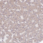 Immunohistochemical staining of human liver shows weak to moderate cytoplasmic positivity in hepatocytes.