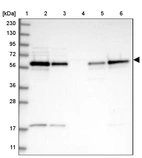 Lane 1: Marker [kDa] 230, 130, 95, 72, 56, 36, 28, 17, 11_br/_Lane 2: Human cell line RT-4_br/_Lane 3: Human cell line U-251 MG_br/_Lane 4: Human plasma_br/_Lane 5: Human Liver tissue_br/_Lane 6: Human Tonsil tissue