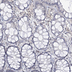 Immunohistochemical staining of human colon shows no positivity in glandular cells as expected.