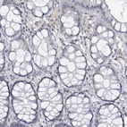 Immunohistochemical staining of human colon shows no positivity in glandular cells as expected.