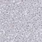 Immunohistochemical staining of human liver shows no positivity in hepatocytes as expected.