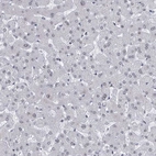 Immunohistochemical staining of human liver shows no positivity in hepatocytes as expected.
