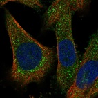 Immunofluorescent staining of human cell line U-251 MG shows localization to cytosol.