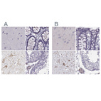 Anti-CALCR Antibody