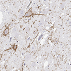 Immunohistochemical staining of human hypothalamus using Anti-CALCR antibody HPA028962.