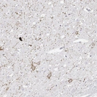 Immunohistochemical staining of human hypothalamus shows strong membranous positivity in neuronal cells bodies and processes.