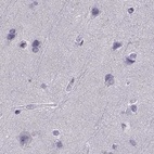 Immunohistochemical staining of human cerebral cortex using Anti-CALCR antibody HPA028962.