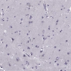 Immunohistochemical staining of human cerebral cortex shows no membranous positivity in neurons as expected.