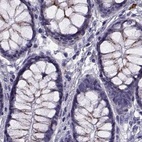 Immunohistochemical staining of human colon using Anti-CALCR antibody HPA028962.