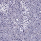 Immunohistochemical staining of human pancreas shows no membranous positivity in exocrine glandular cells as expected.