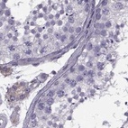 Immunohistochemical staining of human testis using Anti-CALCR antibody HPA028962.