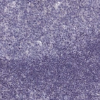 Immunohistochemical staining of human tonsil shows no membranous positivity in non-germinal center cells as expected.