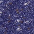 Immunohistochemical staining of human thymus using Anti-PSMB11 antibody HPA028967.