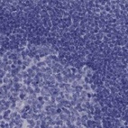 Immunohistochemical staining of human lymph node using Anti-PSMB11 antibody HPA028967.
