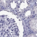 Immunohistochemical staining of human kidney using Anti-PSMB11 antibody HPA028967.