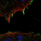 Immunofluorescent staining of human cell line RT4 shows localization to focal adhesion sites.