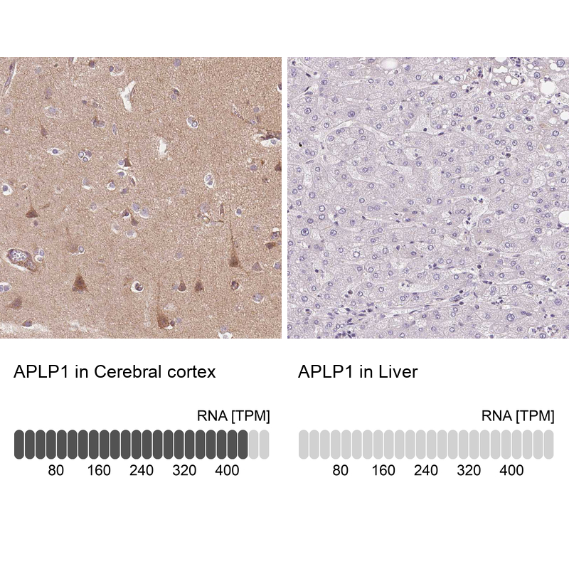 Anti-APLP1 Antibody