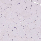 Immunohistochemical staining of human skeletal muscle shows no positivity in myocytes as expected.