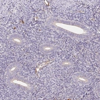 Immunohistochemical staining of human endometrium shows no positivity in glandular cells as expected.