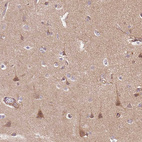 Immunohistochemical staining of human cerebral cortex shows moderate cytoplasmic positivity in neurons.