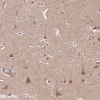 Immunohistochemical staining of human cerebral cortex shows moderate cytoplasmic positivity in neurons.
