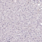 Immunohistochemical staining of human liver shows no positivity in hepatocytes as expected.