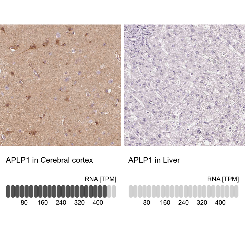 Anti-APLP1 Antibody