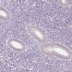 Immunohistochemical staining of human endometrium shows no positivity in glandular cells as expected.