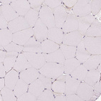 Immunohistochemical staining of human skeletal muscle shows no positivity in myocytes as expected.