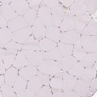 Immunohistochemical staining of human skeletal muscle shows no positivity in myocytes as expected.