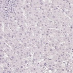 Immunohistochemical staining of human liver shows no positivity in hepatocytes as expected.