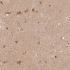 Immunohistochemical staining of human cerebral cortex shows moderate cytoplasmic positivity in neurons.