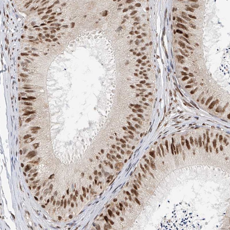 Anti-ZNF514 Antibody