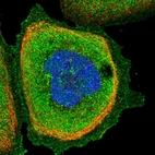 Immunofluorescent staining of human cell line A-431 shows localization to plasma membrane & cytosol.