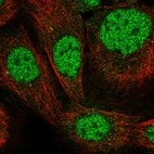 Immunofluorescent staining of human cell line A-431 shows localization to nucleoplasm.