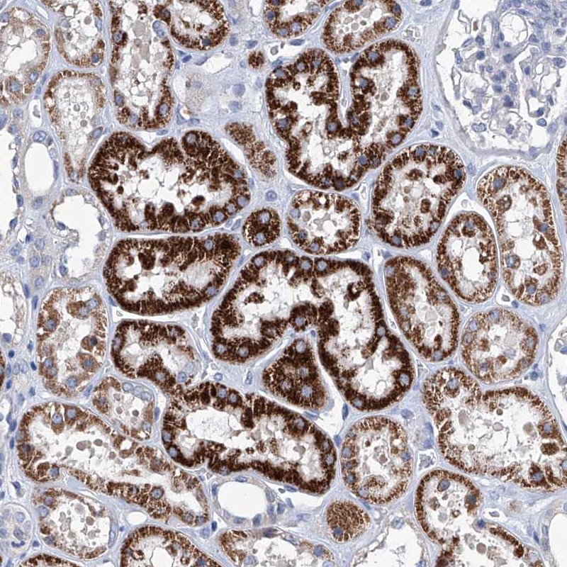 Anti-ZNF519 Antibody