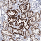 Anti-ZNF519 Antibody
