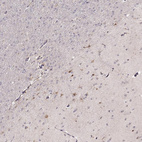 Immunohistochemical staining of human cerebral cortex shows moderate cytoplasmic and nuclear positivity in neuronal and glial cells.